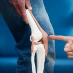 Robotik Diz Protezi Ameliyatı (1)